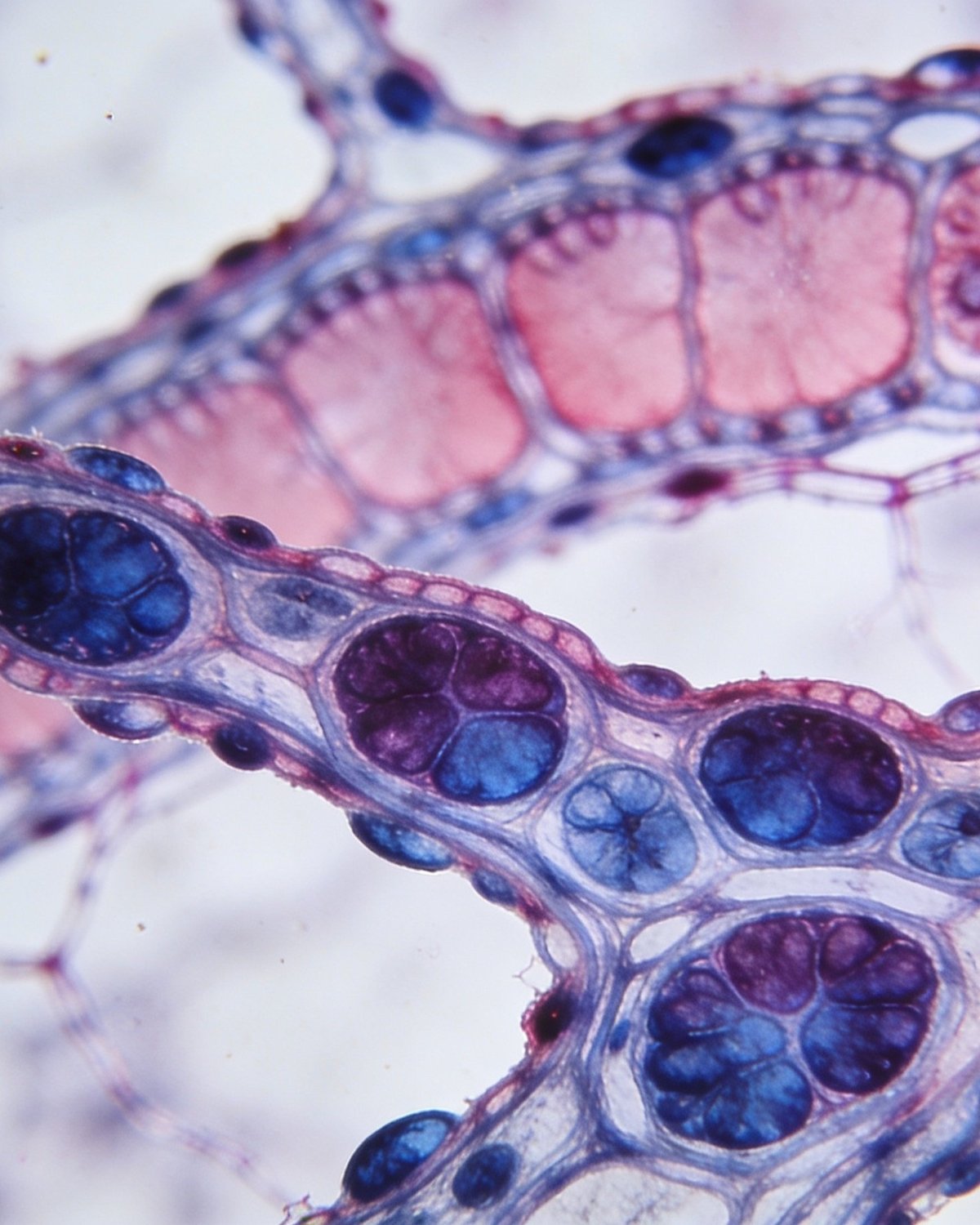 Stained tissue under microscope — cellular structure of glandular tissue, similar to the milk-duct cells where most breast cancers originate.